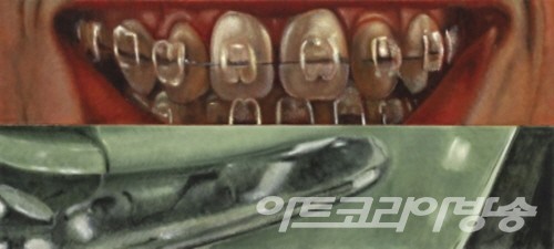 이시 우드 한국 첫 전시 _ 초현실주의와 결합한 새로운 리얼리즘